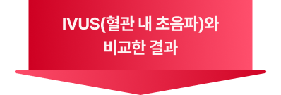IVUS 결과