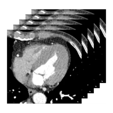 CT data